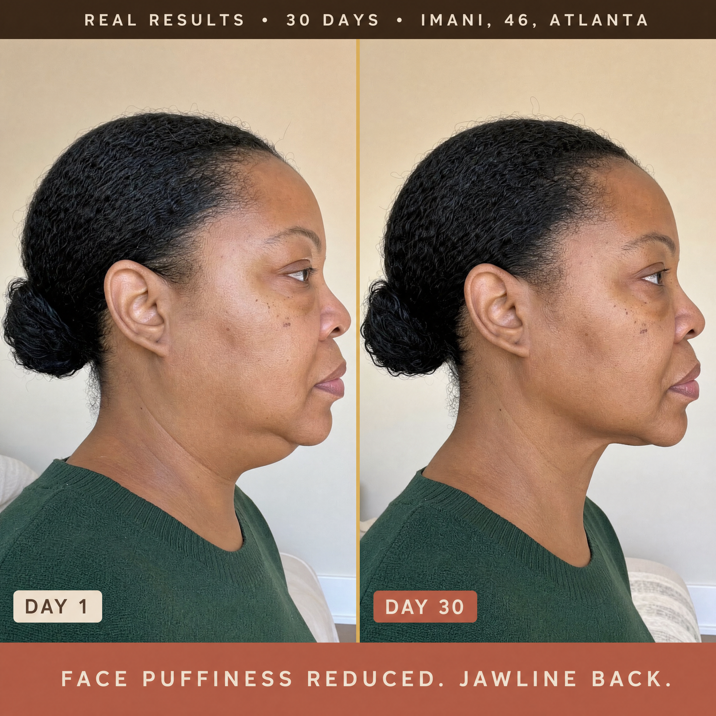 Lymphatic Drainage Drops