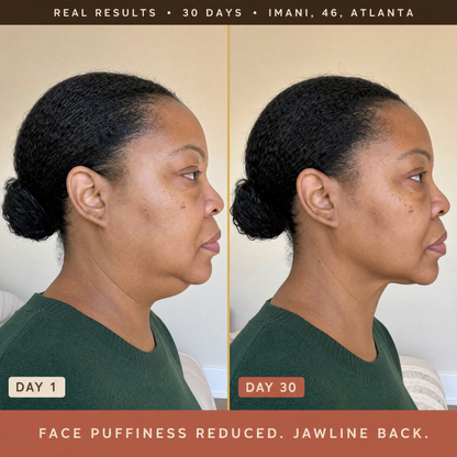 Lymphatic Drainage Drops